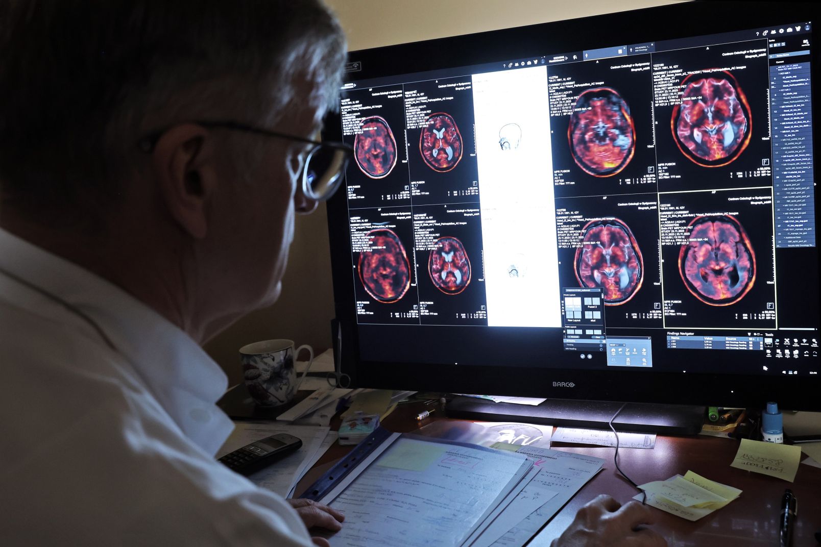 Prof. Małkowski siedzi przed monitorem, na którym wyświetlane są zdjęcia mózgu